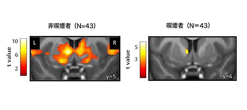 チョコレートをもらったときの脳の反応性の違い